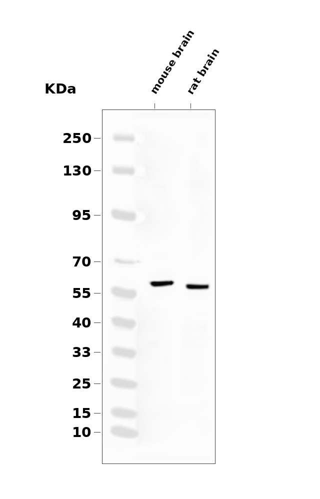 Tyrosine Hydroxylase Rabbit mAb