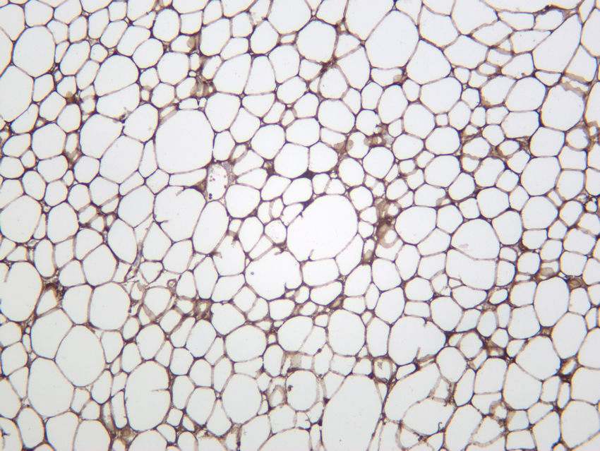 Perilipin-1 Rabbit mAb