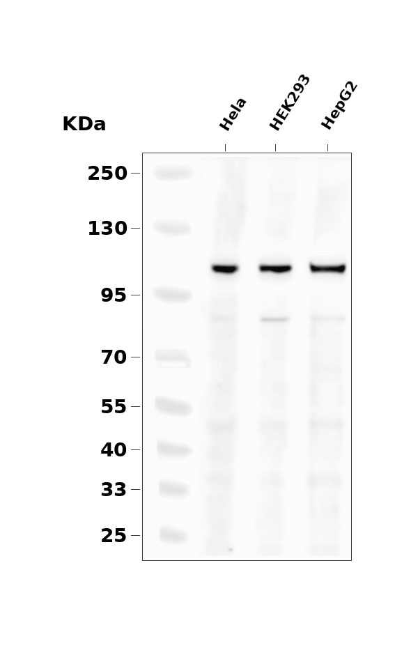 STAT2 Rabbit mAb