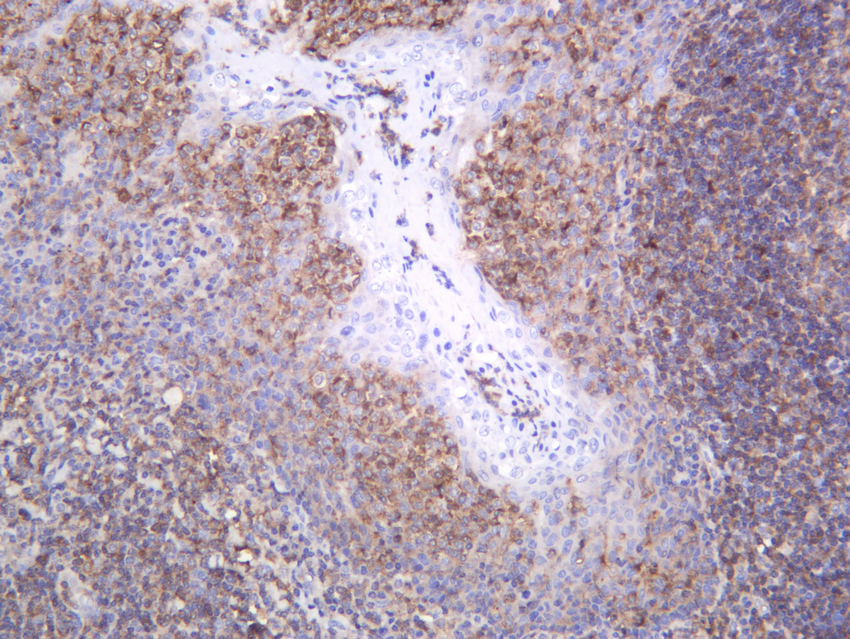 AIM2  Rabbit mAb