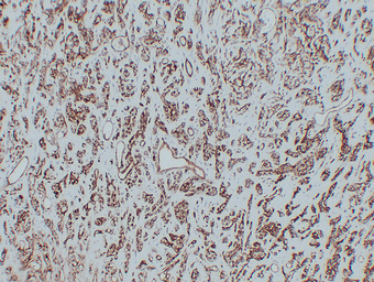 CD31 Mouse mAb