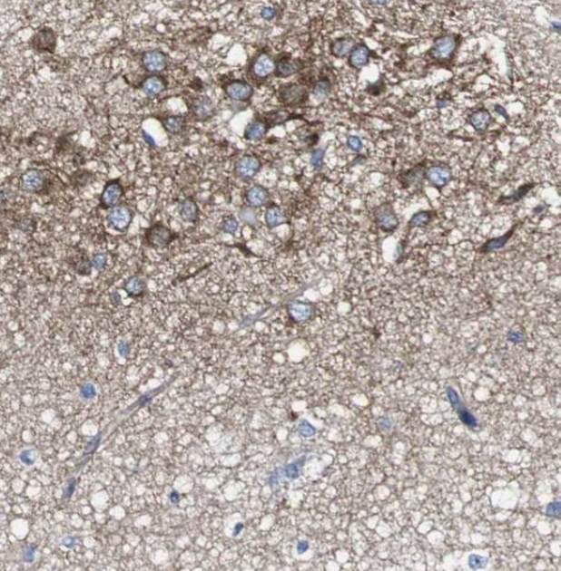 CSF1R (YD16486) Rabbit mAb