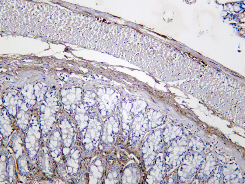 Periostin Rabbit mAb