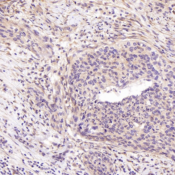 SATB2 Rabbit mAb