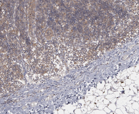 Huntingtin (YD14727) Rabbit mAb