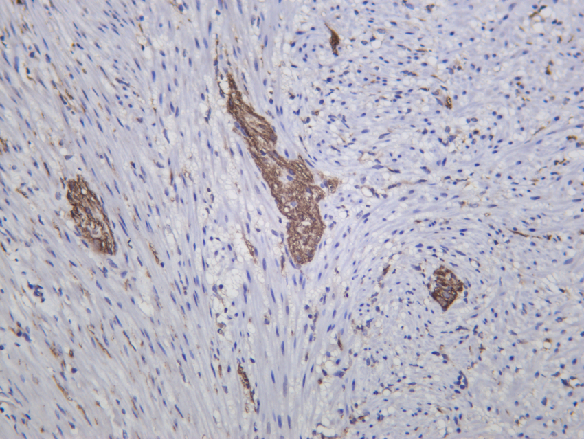 GABARAPL2  Rabbit mAb