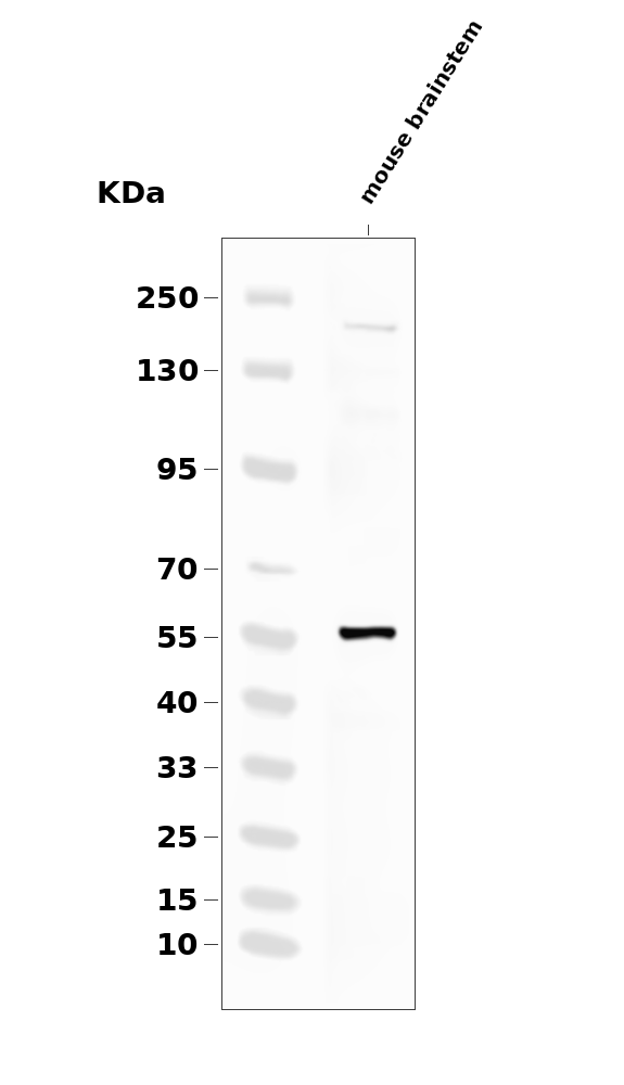 Tyrosine Hydroxylase (Phospho-Ser31) Antibody