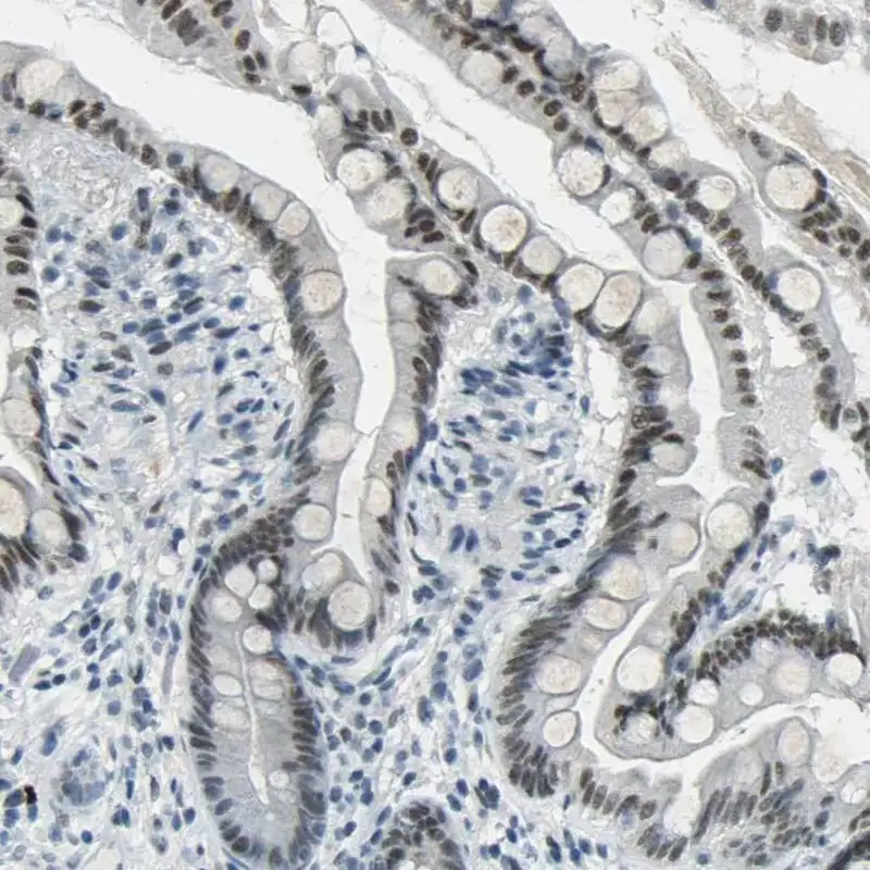 CEBP Beta (YD13975) Rabbit mAb