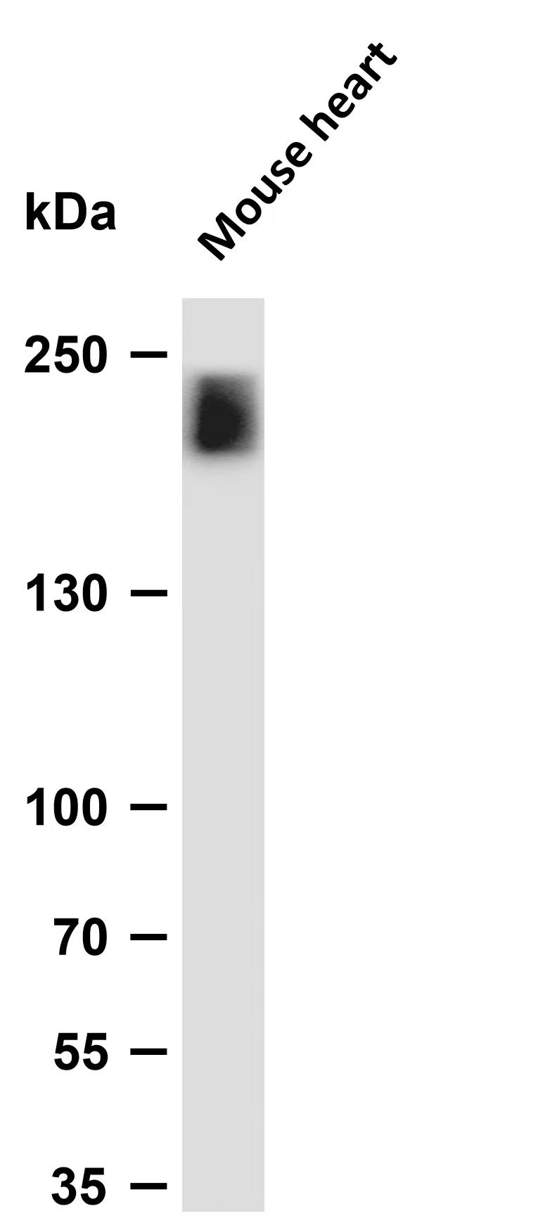 Phospho-MLC2 (Ser15) pAb