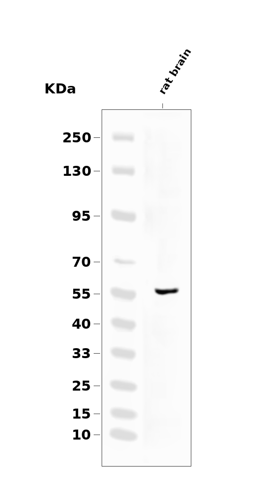 Tyrosine 3-monooxygenase (Ser70) (YD13730) Rabbit mAb