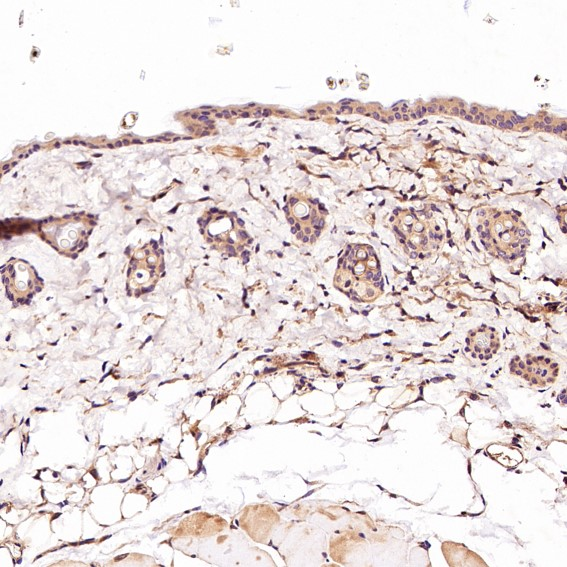 CD45 Rabbit mAb