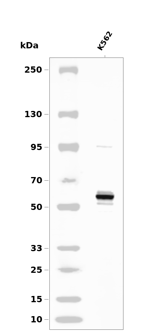 p62 Dok (Phospho-Tyr362) Antibody