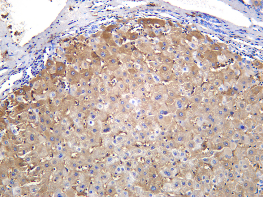FGF21 Rabbit mAb