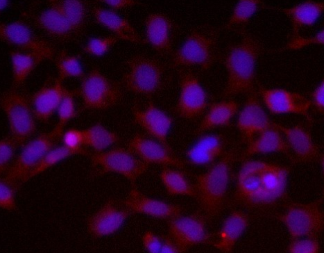 Notch1  Rabbit mAb