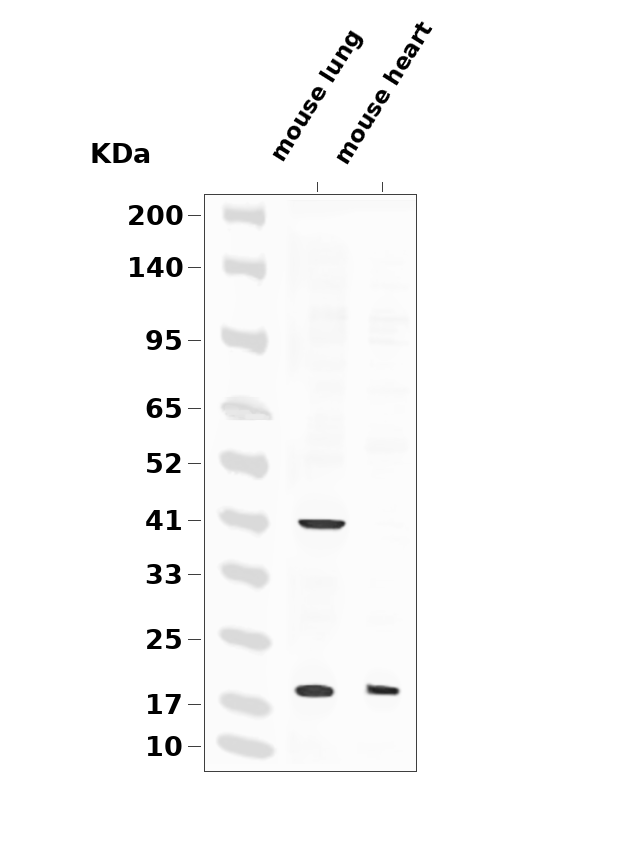 Claudin 5 (YD11324) Rabbit mAb