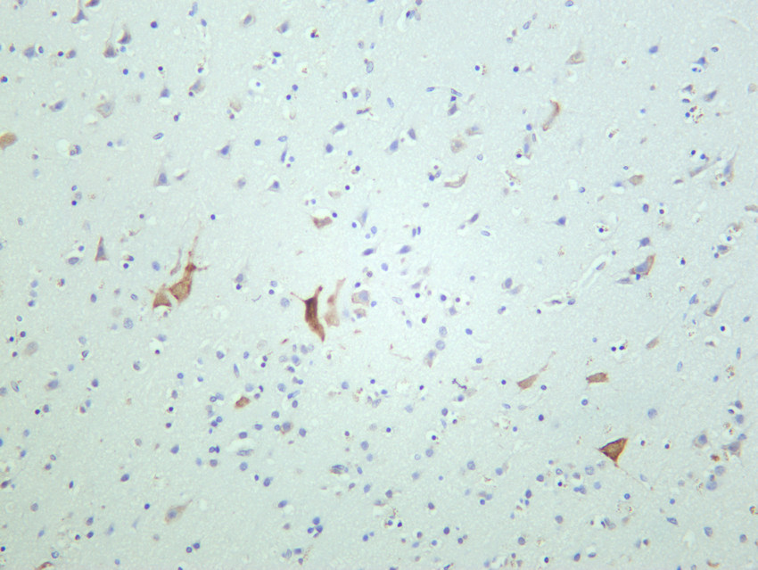 RPS6 (Phospho Ser240/Ser244) Rabbit mAb