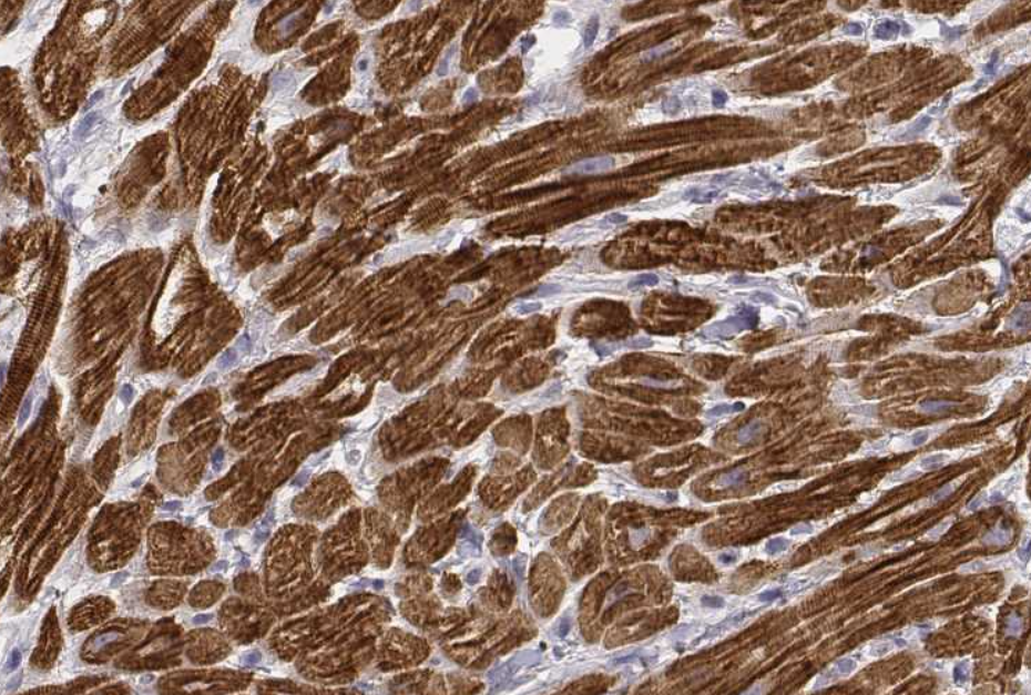 MYL6 Antibody