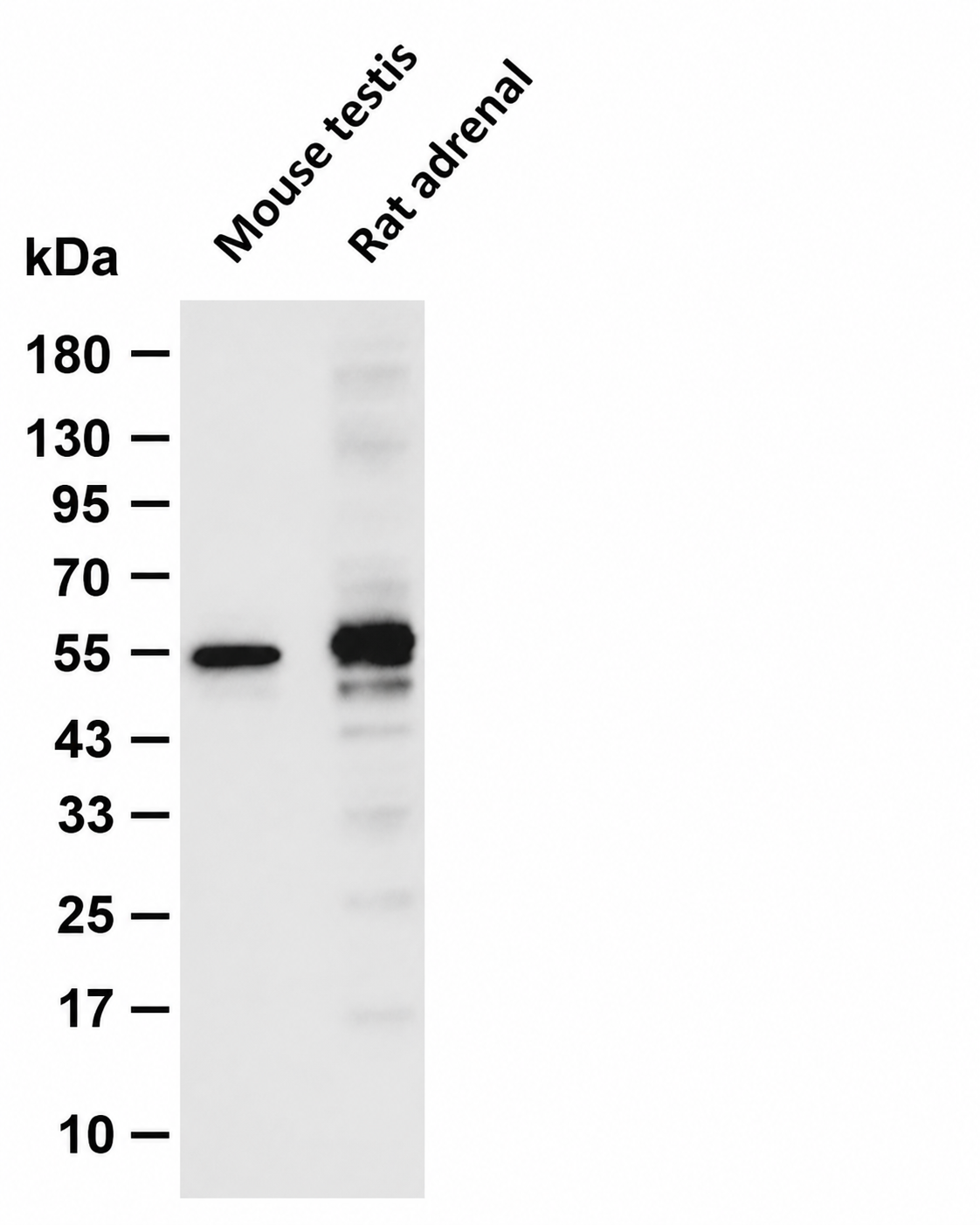 CYP11A1 Rabbit mAb