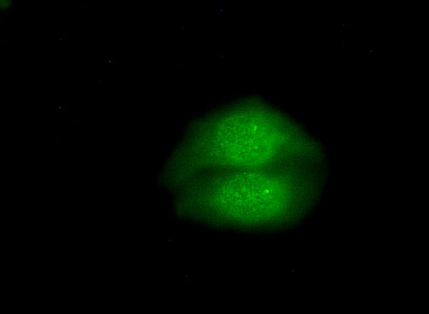 Phospho-beta Catenin (Ser675) pAb