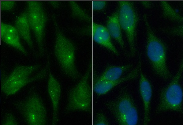 Aryl Hydrocarbon Receptor (YD14499) Rabbit mAb
