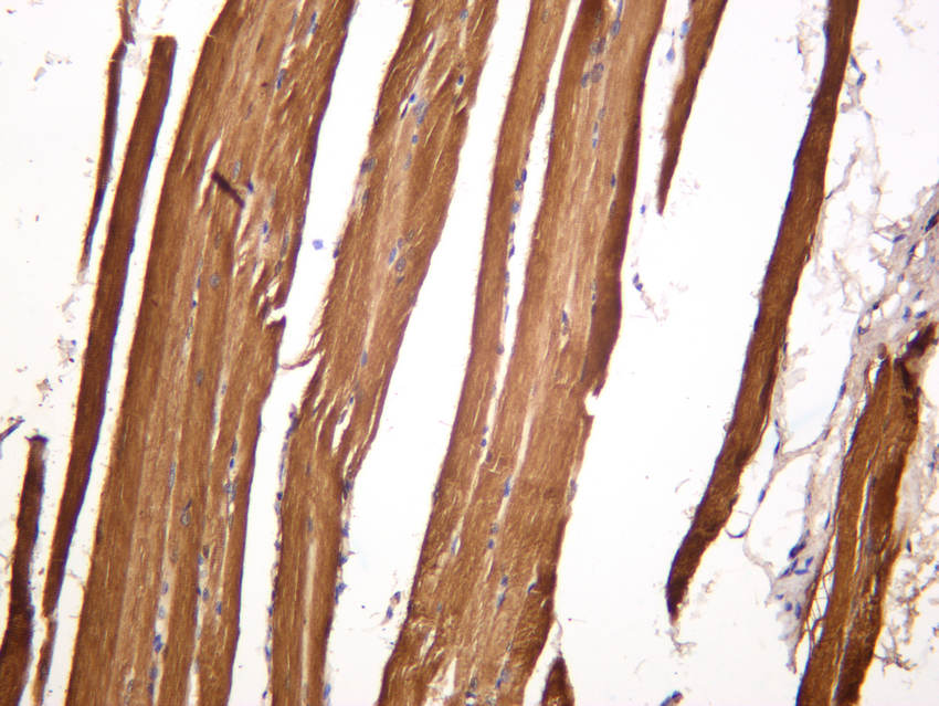 ALDOA Rabbit mAb
