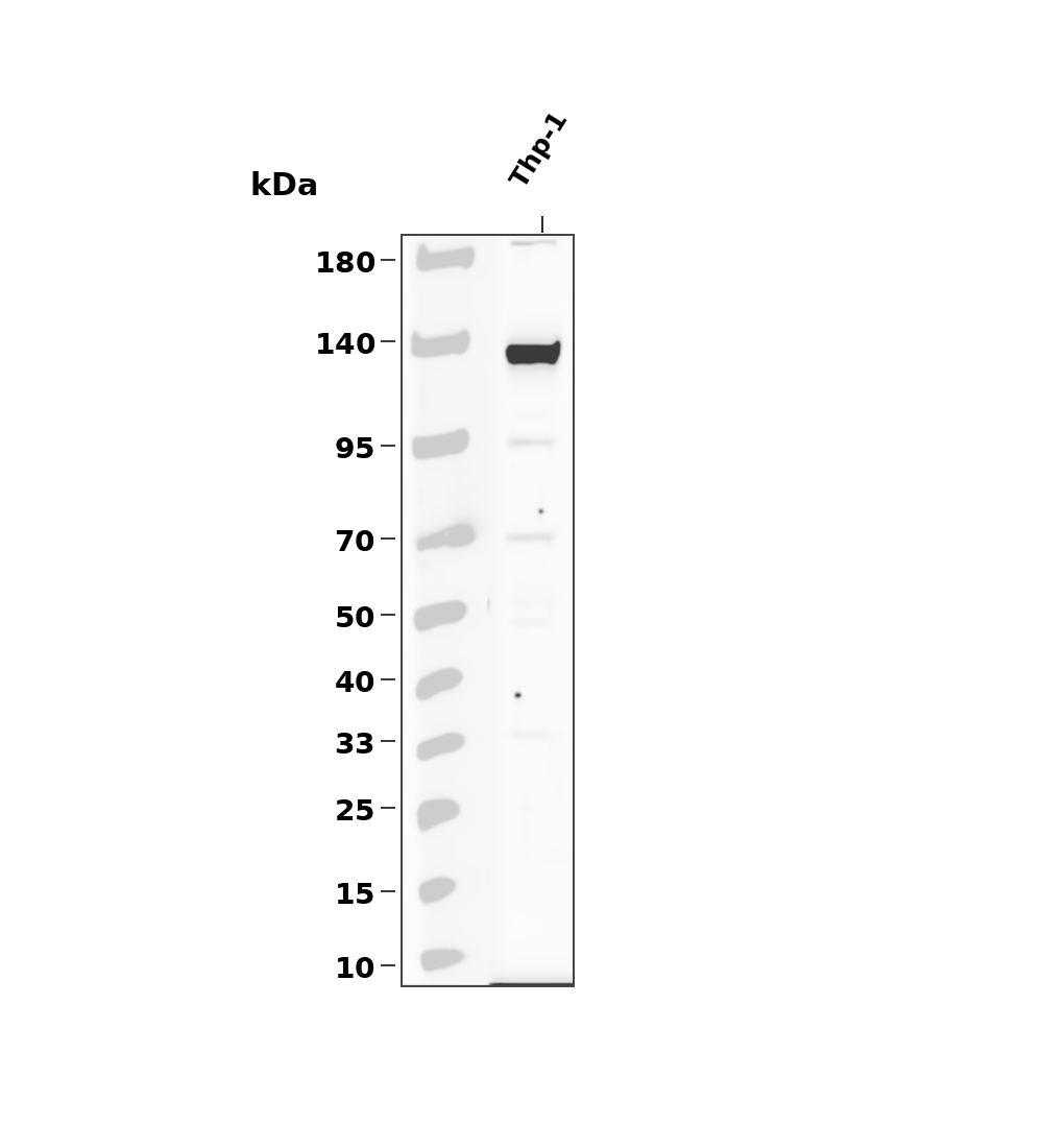 CSFR (Phospho-Tyr723) Antibody