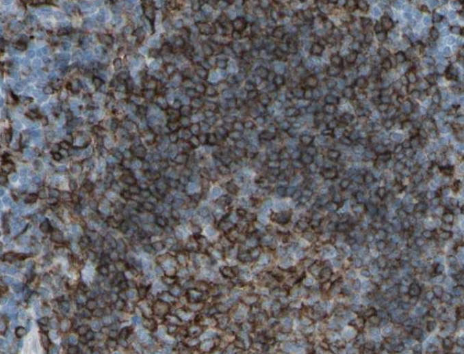 MHC Class II (YD14101) Rabbit mAb