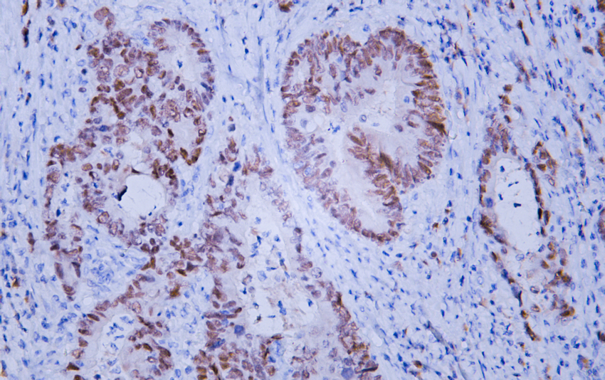 SOX9 Mouse mAb