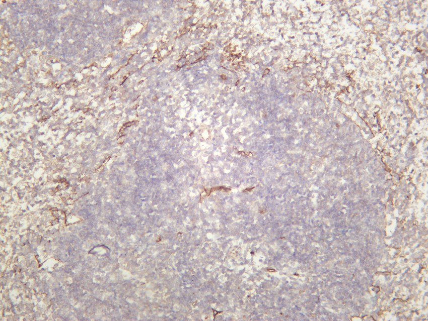 CD36 Rabbit mAb