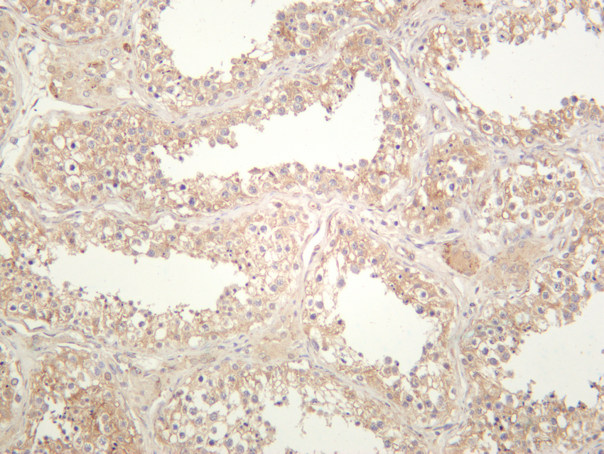 Cleaved Notch 2 (Val1697) Antibody