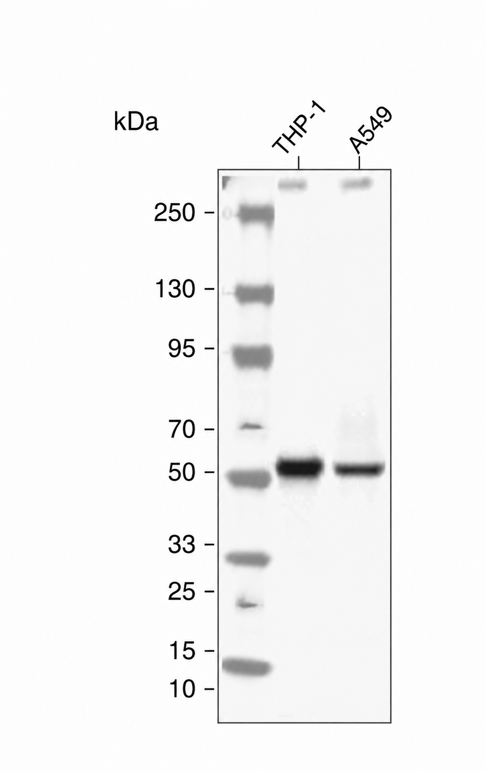 Arrestin-&beta;-1 Rabbit mAb